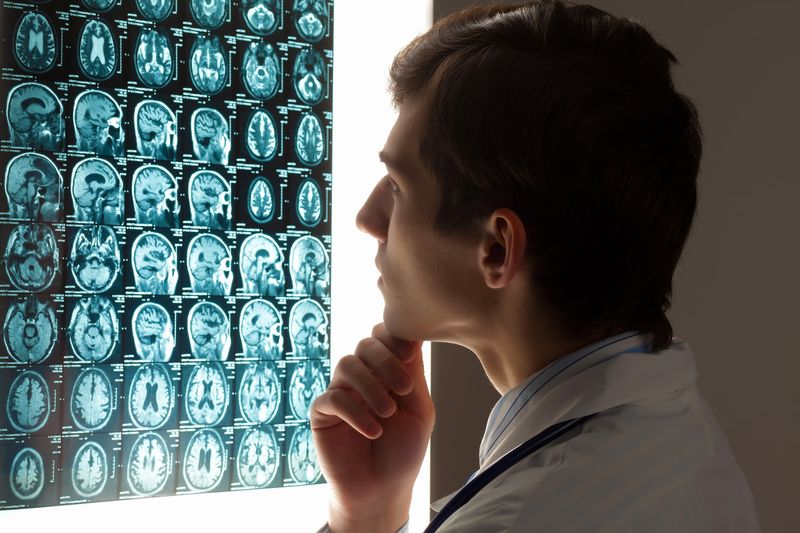 average traumatic brain injury settlement